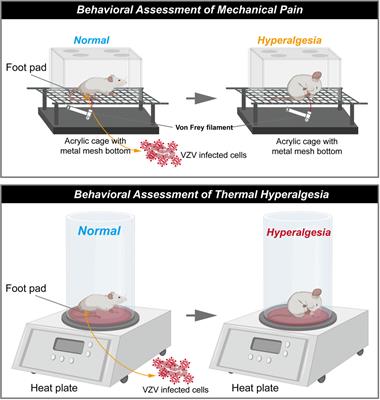 Rodent models of postherpetic neuralgia: How far have we reached?